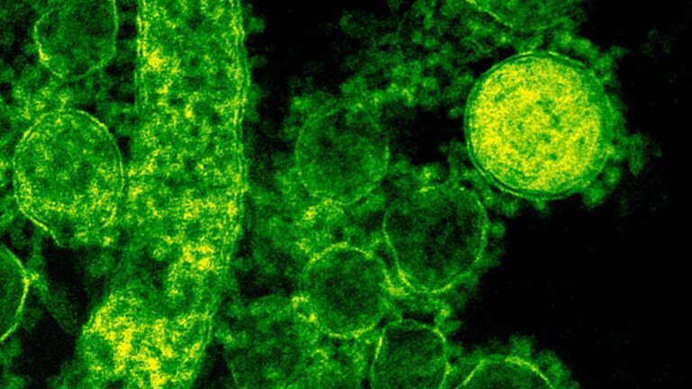 Ómicron es ‘bastante infecciosa’ pero no debe cundir el pánico: científica jefa de la OMS