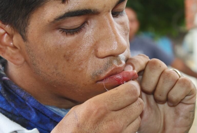 Caravana migrante presiona a autoridades en Tapachula con sutura de labios